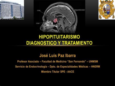 Hipopituitarismo Diagnostico Y Manejo Ppt