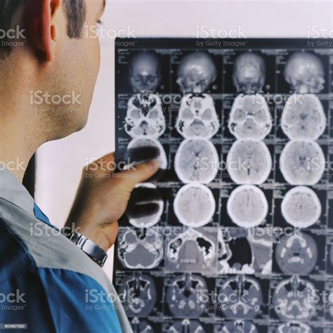 Ctscan Van De Hersenen Mri Van De Hersenen Arts Kijken Naar De