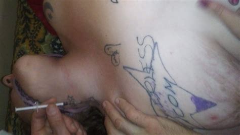 Girl Shooting Meth Photos Sex And Porn