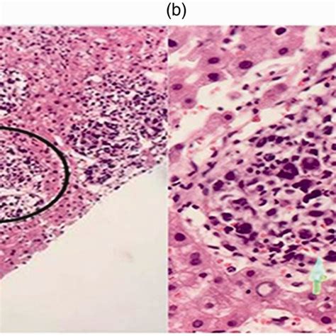 Results Of Hematoxylin And Eosin Staining Of A Liver Specimen A Low