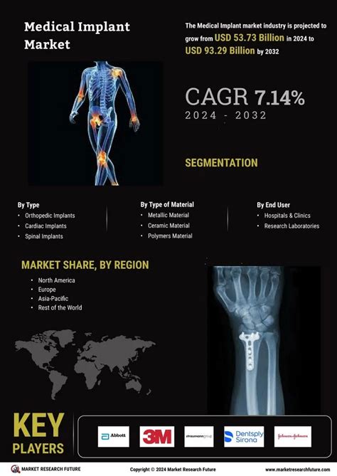 Medical Implants Market Size Share Growth Report 2032