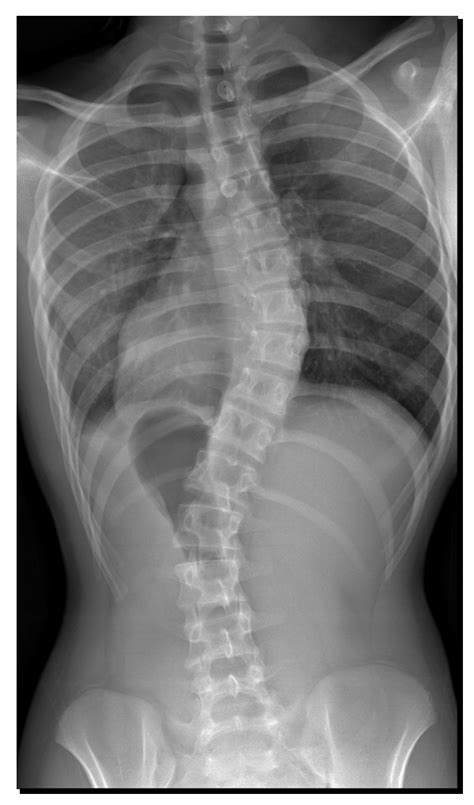 Example Of A Radiograph Pair From The Same Patient Showing A Download Scientific Diagram