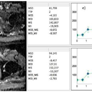 Dynamic Contrast Enhanced Magnetic Resonance Imaging And Standardized