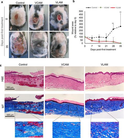 Effects Of Vlam In A Diabetic Mouse Chronic Wound Model A