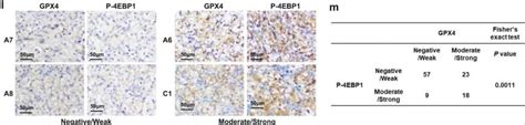 Glutathione Peroxidase 4 GPX4 Antibody NBP2 54979 Novus Biologicals