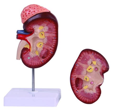 Anatomy Kidney with Adrenal Gland Model - China Anatomy Kidney and 1.5 ...