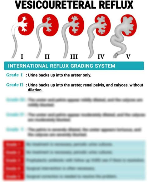 Solution Vesicoureteral Reflux Studypool