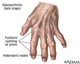 Diseases - Skeletal System