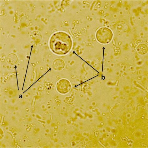 Alignment Of Partial Ssu Rdna Gene Sequences From Blastocystis Sp St6 Download Scientific