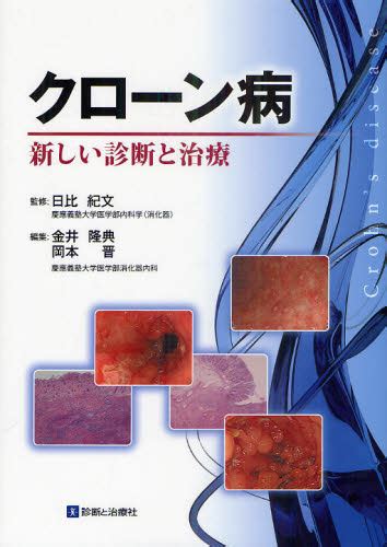 クローン病 新しい診断と治療 日比紀文／監修 金井隆典／編集 岡本晋／編集 消化器一般の本 最安値・価格比較 Yahoo ショッピング｜口コミ・評判からも探せる