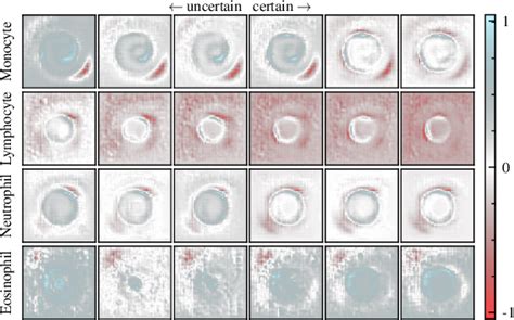 Figure 20 from Towards Interpretable Classification of Leukocytes based ...