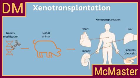 Demystifying Xenotransplantation First Pig To Human Heart Transplant