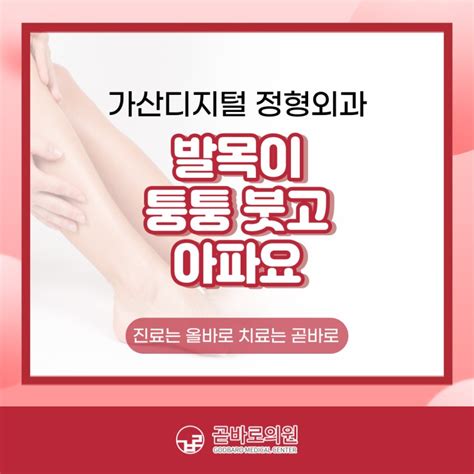 가산디지털단지역 정형외과 발목이 퉁퉁 붓고 아파요 네이버 블로그