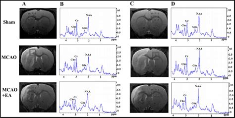 Neurochemical Changes In The Hippocampus And Prefrontal Cortex