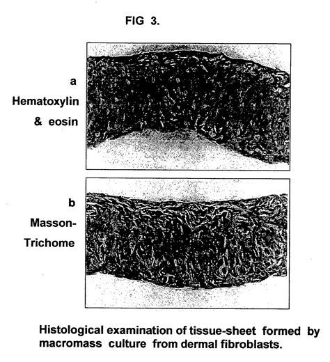 Epidermal cells/skin cells patented technology retrieval search results