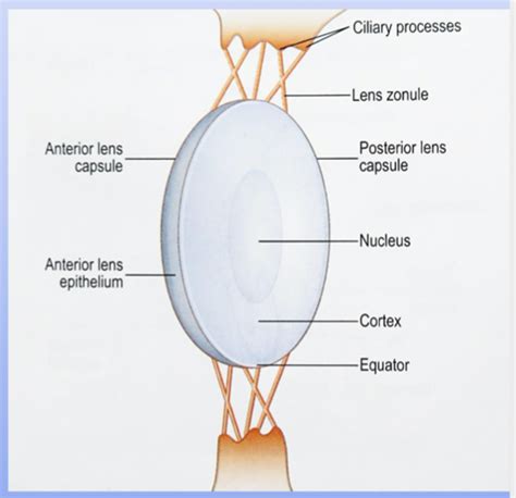 Lens And Glaucoma Flashcards Quizlet