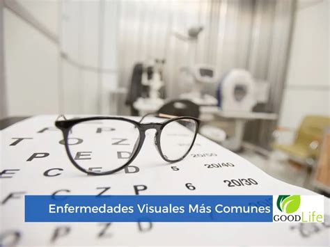 Enfermedades Visuales Más Comunes Guía Completa