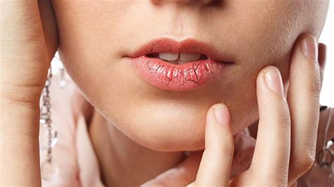 Labios Resecos Por Qué Se Resecan Y Cómo Cuidarlos El Aragueño