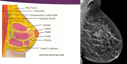 Lab B Breast Imaging Flashcards Quizlet