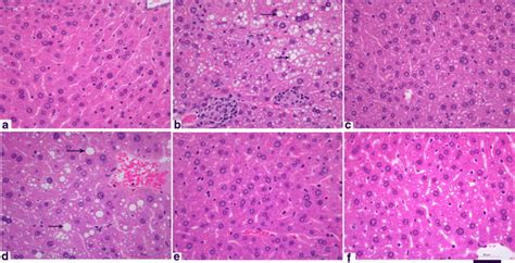 Hematoxylin And Eosin He Stained Images Of Liver Histopathology From