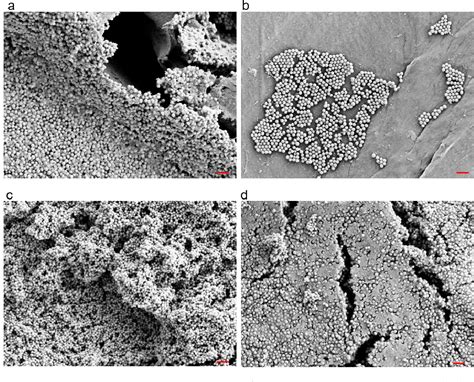 Figure 1 From Effective Biofilm Eradication On Orthopedic Implants With