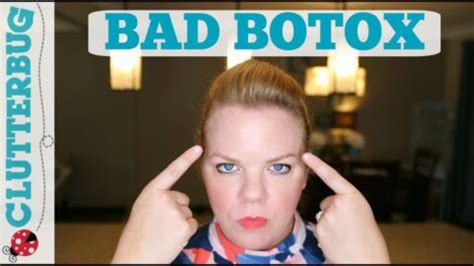 My Bad Botox Experience - Clutterbug