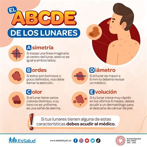 Essalud Per On Twitter Te Presentamos El Abcde De Los Lunares