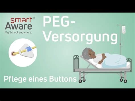 PEG Versorgung Pflege Eines Buttons Fachfortbildungen Pflege