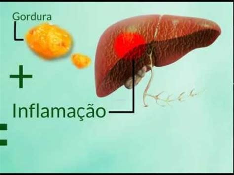 Vinho Faz Mal Para O Fígado - Vinho e Saúde do Fígado: Mitos e Verdades | Actualizado mayo 2026