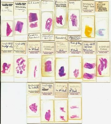 Human Pathology Microscope Slides -- Antique Price Guide Details Page