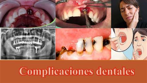 La Odontolog A Y Que Implica Cuales Carreras Se Ven Y Cuantos A Os Dura