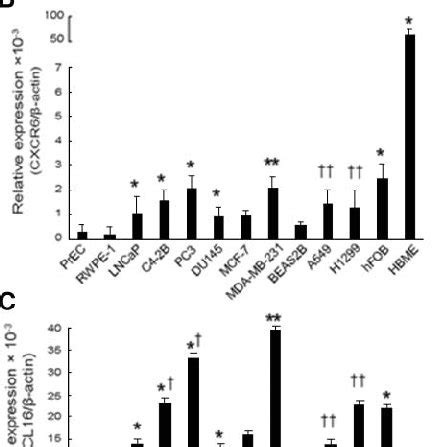 Cxcr Mrna And Cxcl Mrna Are Expressed In Prostate Cancer Cells The