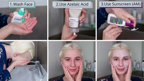 How to use azelaic acid and lactic acid