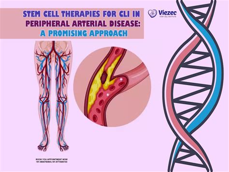 Stem Cell Therapies For Cli In Peripheral Arterial Disease