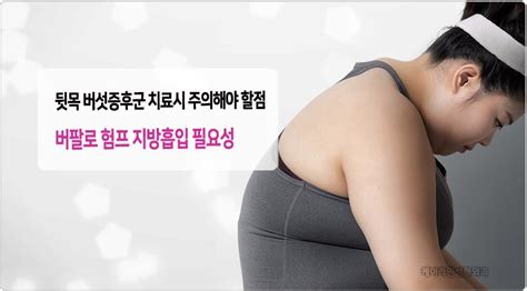 버섯증후군 치료시 주의해야 할점과 해결방안~ 버팔로 험프 지방흡입 케이라인 자주묻는질문