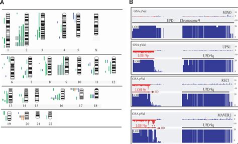 Uniparental Disomy And Uniparental Trisomy In Mcl A Ideogram Of The