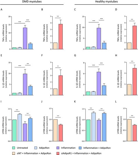 Effects Of Adiporon Treatment On Human Myotubes Challenged By