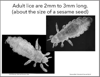 Head Lice, Annoying Parasites - with Scanning Electron Microscope Images