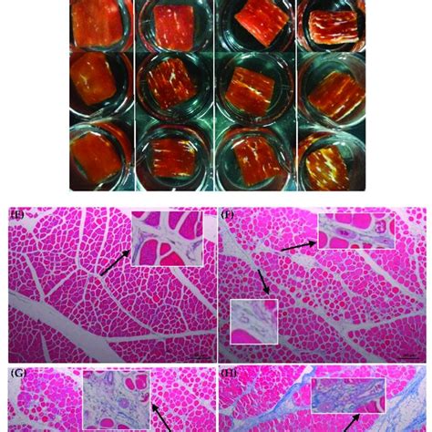 Fourier Transform Infrared FTIR Spectra Of Intramuscular Connective