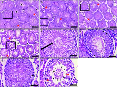 Representative Photomicrographs Of Hande Stained Testicular Section