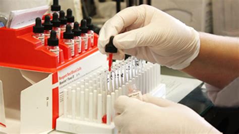 Institute of haematology and transfusion medicine to be set up - Daily ...