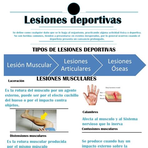 Infografia Lesiones Pdf