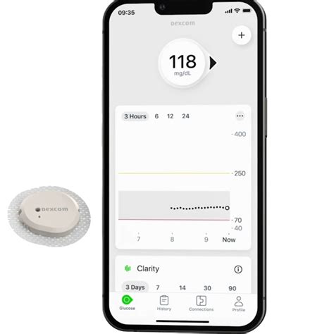 Device Finder Freestyle Lingo Vs Dexcom G7 DiabetesWise