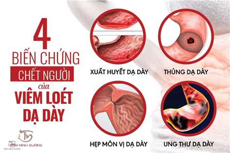 Viêm Loét Dạ Dày Là Gì Nguyên Nhân Triệu Chứng Và Cách điều Trị Hiệu Quả