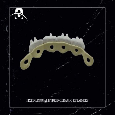 Obstructive Sleep Apnea Syndrom OSAS FN Orthodontics