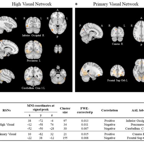 Resting State Networks Rsns Using Ica A Significant Correlations