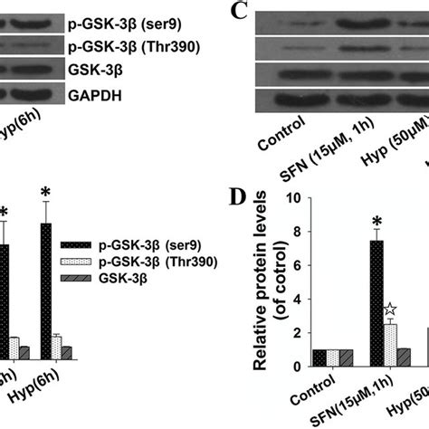 Effects of hyperoside on GSK 3β phosphorylation in L02 cells L02 cells