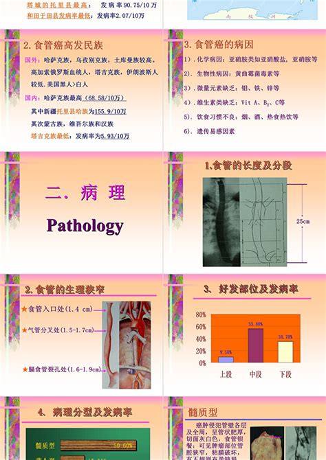 食管癌ppt 卡卡办公