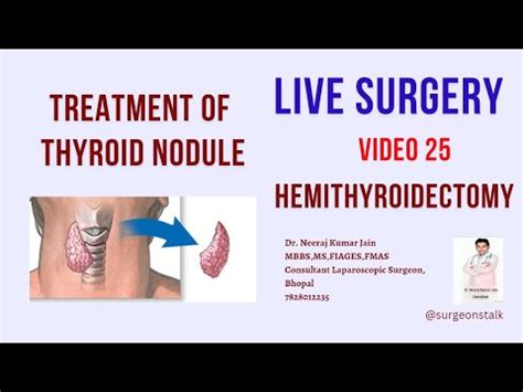 Thyroid Surgery #Hemithyroidectomy .Dr. Neeraj Jain - YouTube