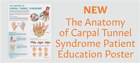 Understanding Carpal Tunnel Syndrome Anatomical Chart Ph